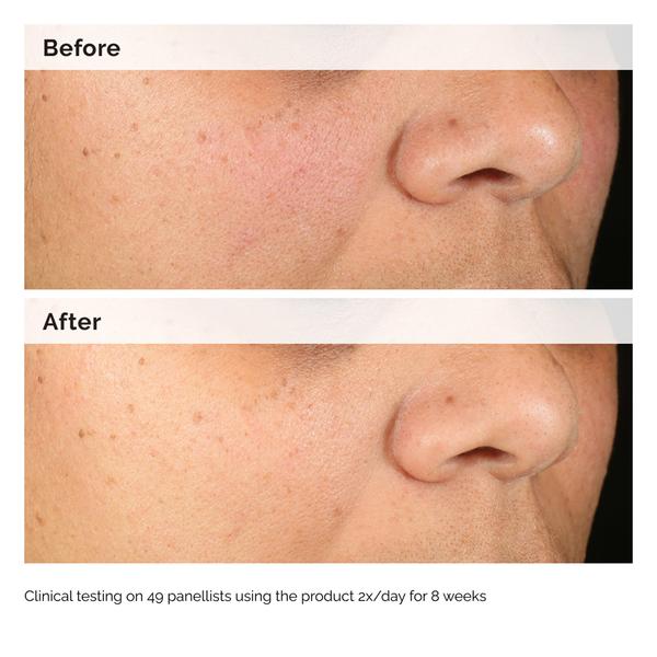 The Ordinary The Ordinary Alpha Arbutin 2% + HA 60ml Serums & Treatments