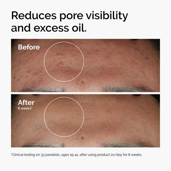 The Ordinary The Ordinary Niacinamide 10% + Zinc 1% 60ml Serums & Treatments