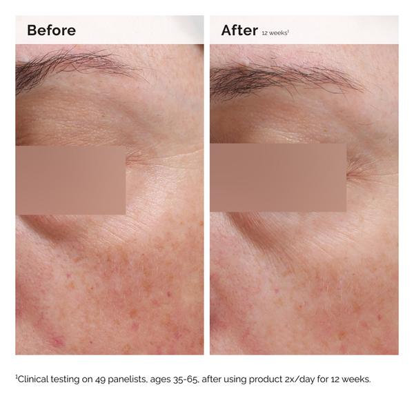 The Ordinary The Ordinary Niacinamide 5% Face and Body Emulsion 100ml Serums & Treatments