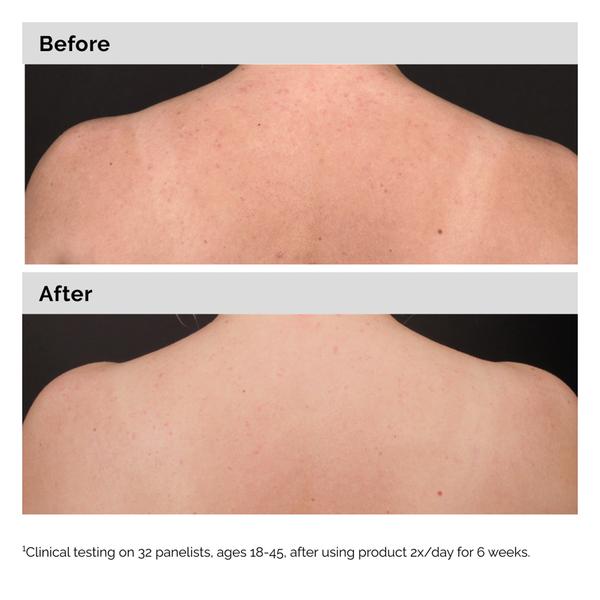 The Ordinary The Ordinary Salicylic Acid 0.5% Body Serum 240ml Serums & Treatments