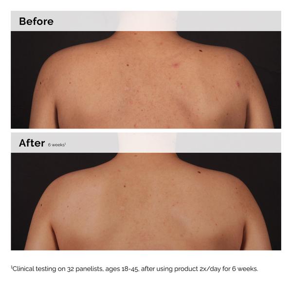 The Ordinary The Ordinary Salicylic Acid 0.5% Body Serum 240ml Serums & Treatments