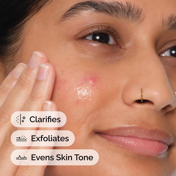 The Ordinary The Ordinary Salicylic Acid 2% Anhydrous Solution 30ml Serums & Treatments