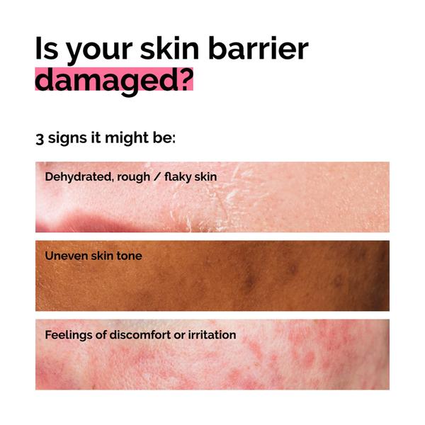 The Ordinary The Ordinary Soothing & Barrier Support Serum 30ml Serums & Treatments