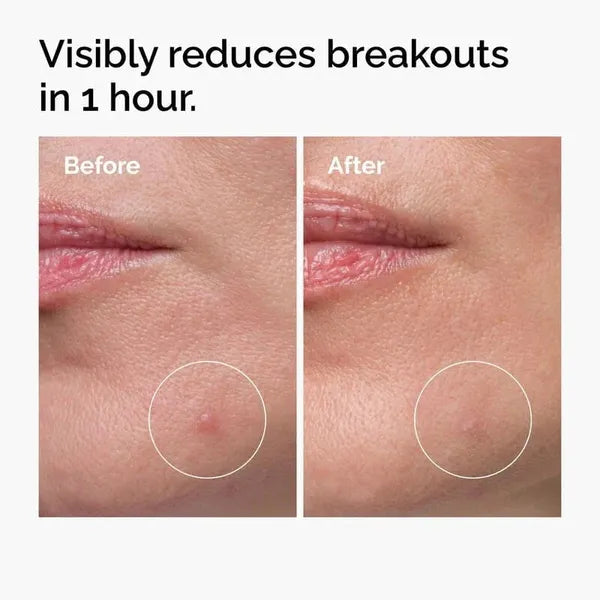 The Ordinary The Ordinary Sulfur 10% Powder-to-Cream Concentrate 5g Serums & Treatments