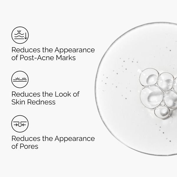 The Ordinary The Ordinary Aloe 2% + NAG 2% 30ml Vitamin C Serum