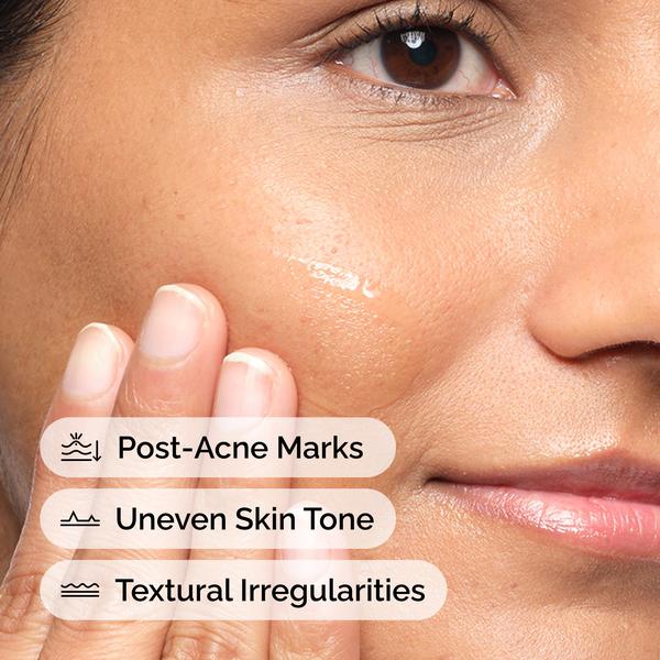 The Ordinary The Ordinary Aloe 2% + NAG 2% 30ml Vitamin C Serum
