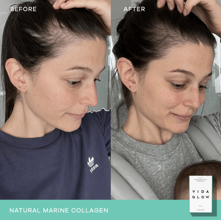 Vida Glow Vida Glow Marine Collagen Mango - 30 x 3g Sachets Collagen Powder