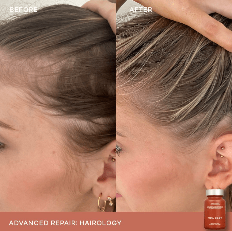Vida Glow Vida Glow Hairology - 30 capsules Hair Supplements