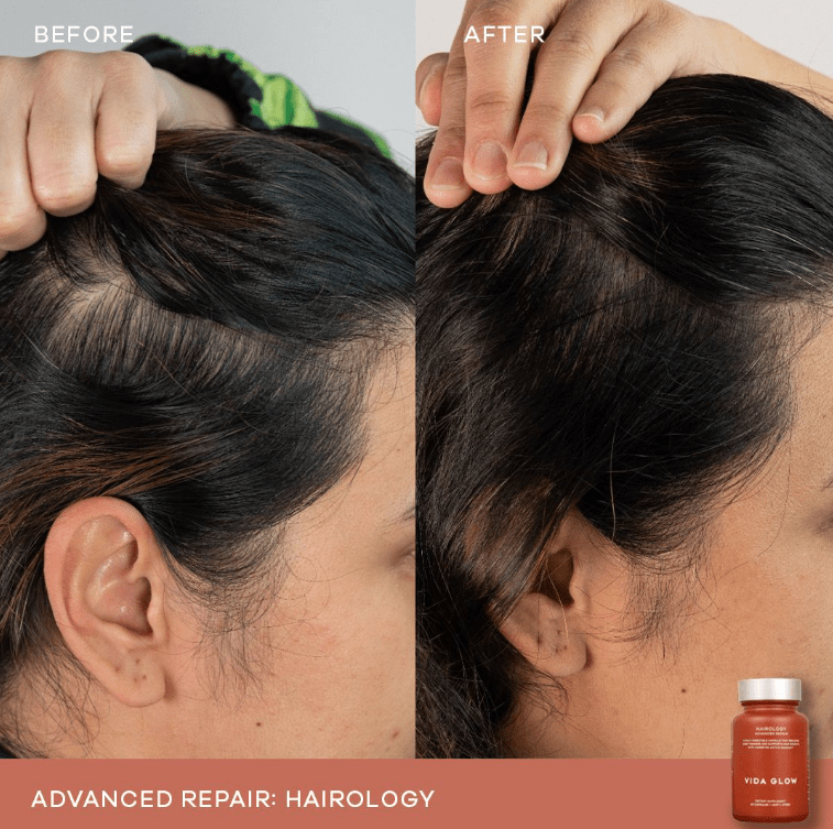 Vida Glow Vida Glow Hairology - 30 capsules Hair Supplements