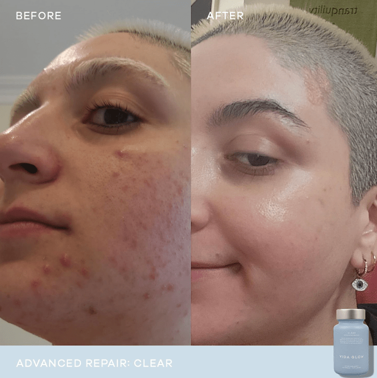 Vida Glow Vida Glow Clear Advanced Repair - 30 capsules 3 Pack Inner Beauty