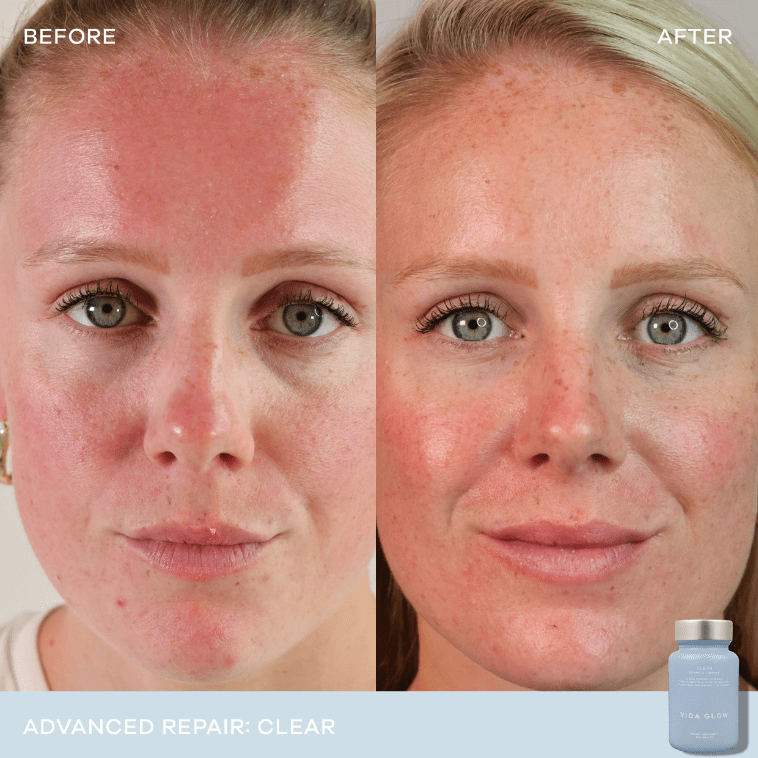 Vida Glow Vida Glow Clear Advanced Repair - 30 capsules 3 Pack Inner Beauty