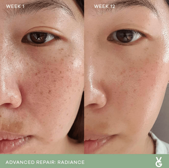 Vida Glow Vida Glow Radiance Advanced Repair - 30 capsules Inner Beauty