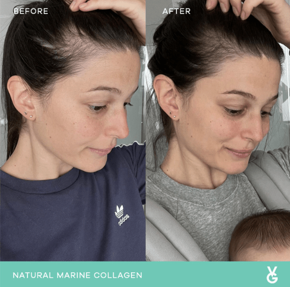 Vida Glow Vida Glow Starter Pack - Natural Marine Collagen Original and Blueberry 14 serves Inner Beauty