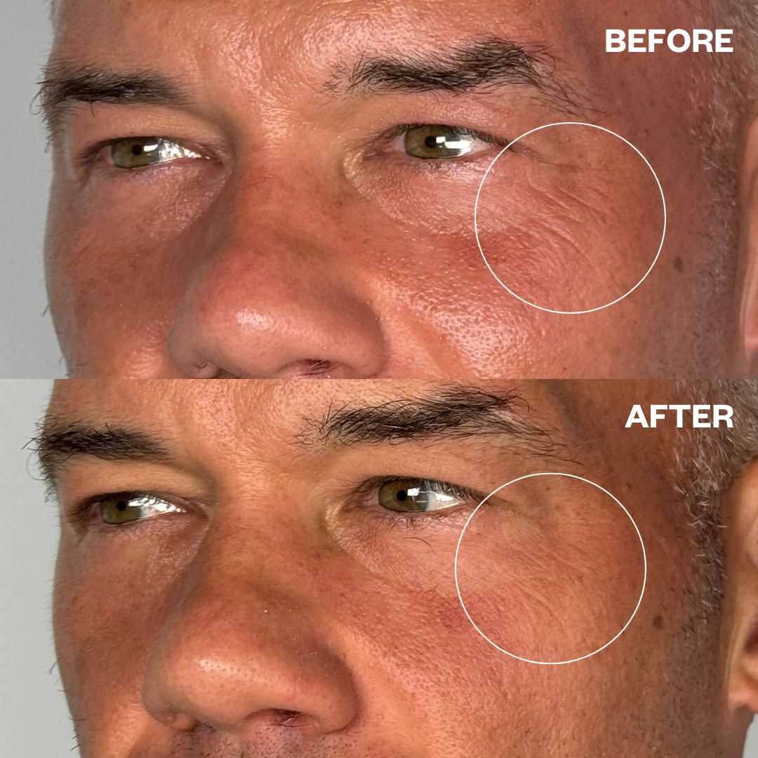 Wrinkles Schminkles Wrinkles Schminkles Men's Pro Eye Wrinkle Patches - 1 Pair Skin Care