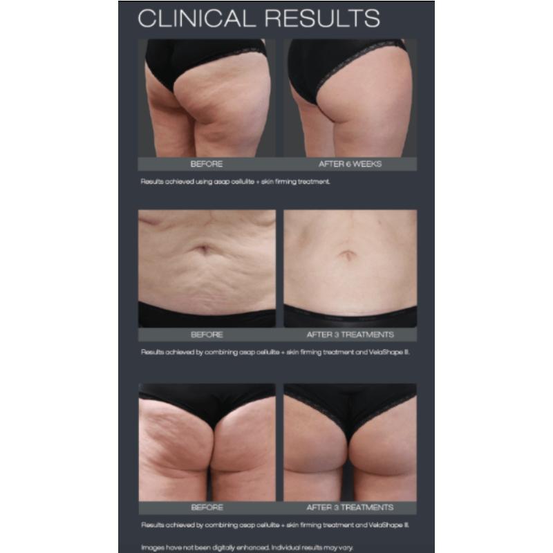 
            
                Load image into Gallery viewer, asap cellulite + skin firming treatment 
            
        