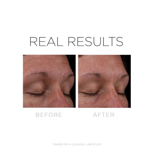CosMedix Serum 16 