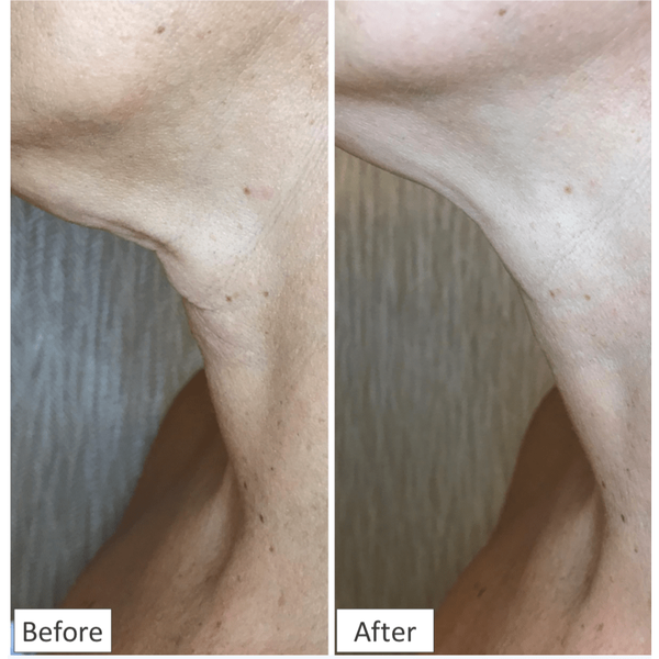 HydroPeptide Firm-a-Fix Nector Lifting Neck & Decollete Serum | primary image