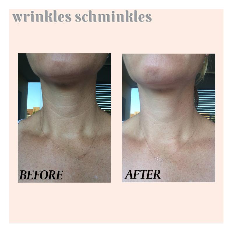 
            
                Load image into Gallery viewer, Wrinkles Schminkles Neck Smoothing Patch
            
        