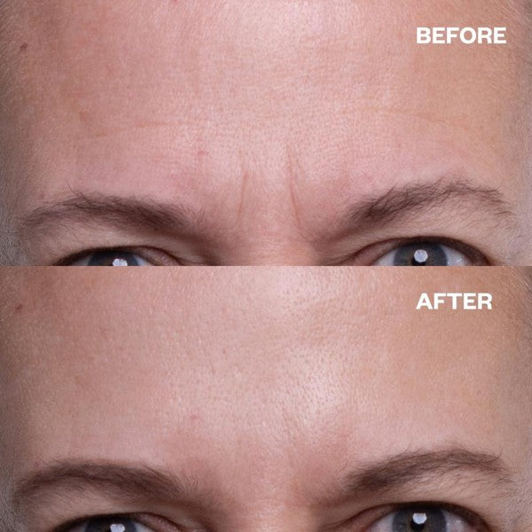 Wrinkles Schminkles Forehead Wrinkle Patches