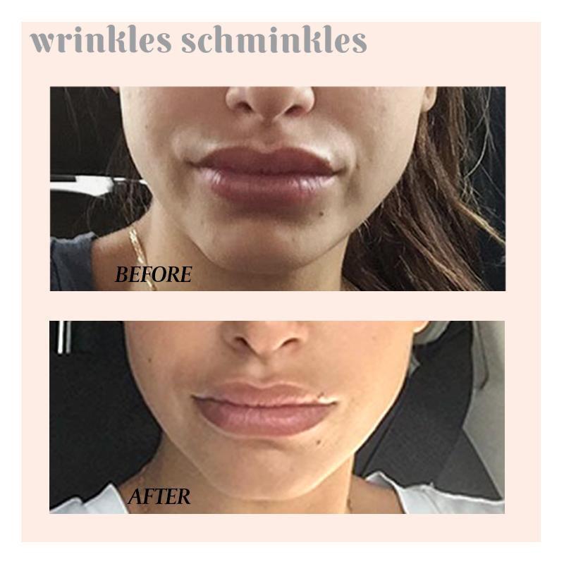 Wrinkles Schminkles Mouth and Lip Smoothing Kit
